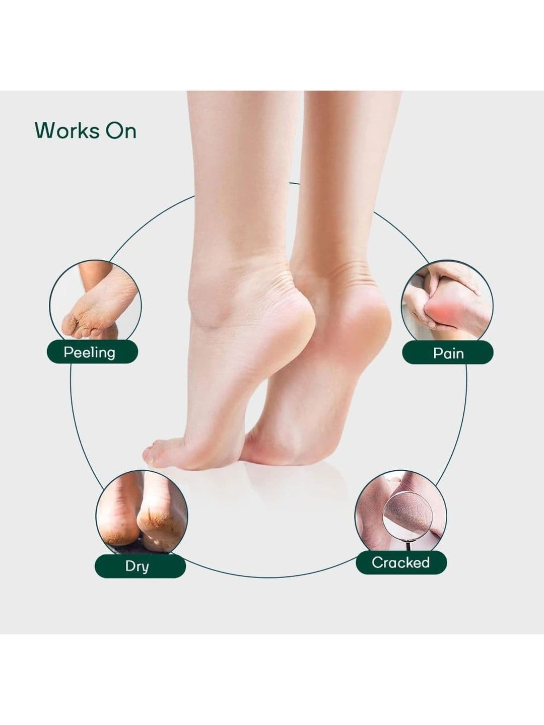 MOUNTAINOR Silicone Gel Heel Foot Socks for Dry Hard Cracked Heels - Grey thumbnail 2